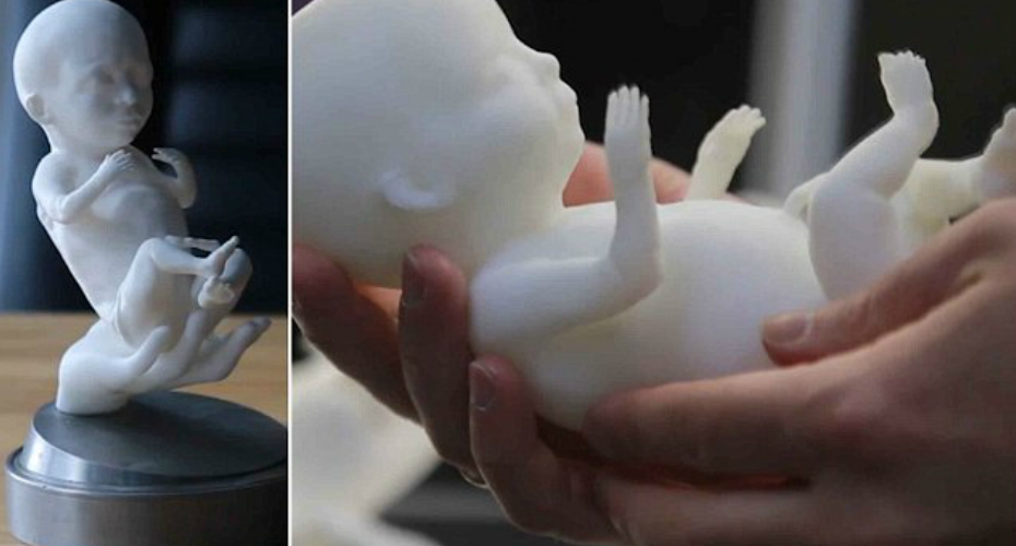 VIDEO: Grávia Recebe Modelo Em 3D Do Seu Feto Após Realizar Ultrassonografia