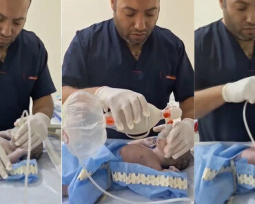 Médico Reanimou Bebé Recém-Nascido e o Momento Comoveu a Internet Médico Reanimou Bebé Recém-Nascido e o Momento Comoveu a Internet