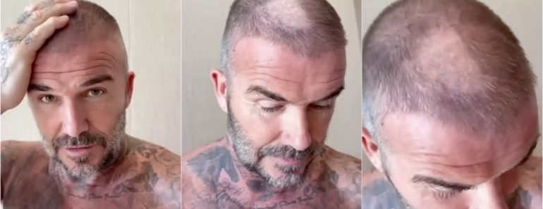 Beckham Sofreu Acidente Ao Cortar o Cabelo e Anda Levou Gozo Da Esposa Beckham Sofreu Acidente Ao Cortar o Cabelo e Anda Levou Gozo Da Esposa