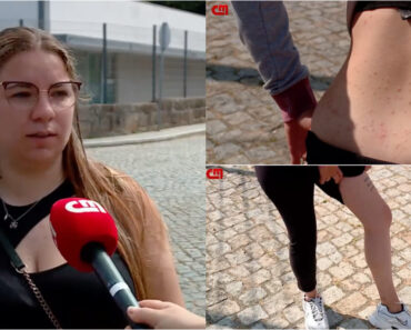Praga De Pulgas Desespera Moradores Na Maia Praga De Pulgas Desespera Moradores Na Maia